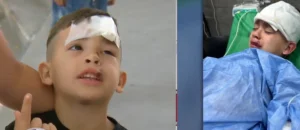 El nene atropellado en Tío Rolo recibió el alta