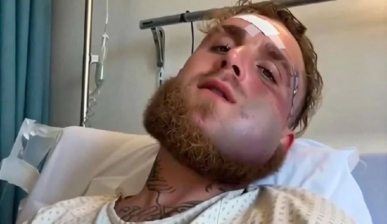 Las dolorosas secuelas del nocaut que sufrió Jake Paul