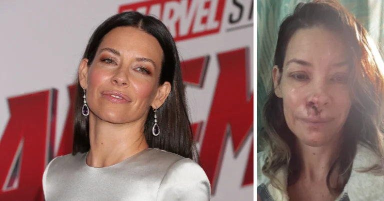 La dura revelación de Evangeline Lilly