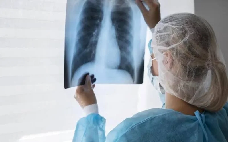 Alerta en Santa Fe por aumento de casos de tuberculosis