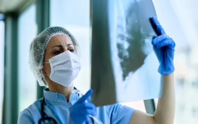 Cáncer de pulmón: aumentan los casos en Santa Fe