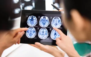 Accidentes cardiovasculares: ¿De qué se tratan las 5C?