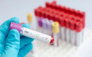 El diagnóstico de VIH aumentó un 30% en Europa
