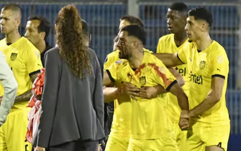 Imputaron al hincha que lesionó al jugador de Peñarol