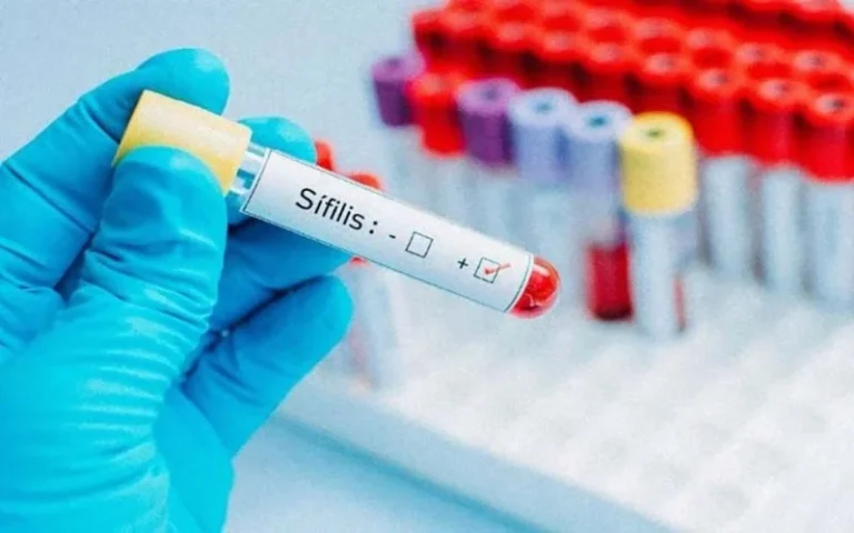 Contagios de sífilis en aumento: los números en Santa Fe
