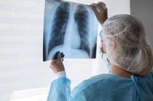 Preocupa el aumento de casos de tuberculosis en Argentina