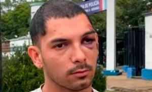 El joven agredido por su amigo habló en Rosario La Ciudad