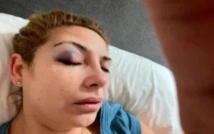 Se conocieron nuevas fotos de Fabiola Yañez con golpes en su cara